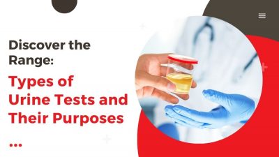 Discover the Range: Types of Urine Tests and Their Purposes