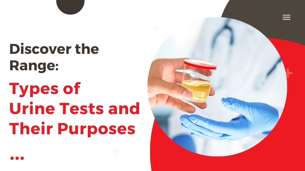 Discover The Range Types Of Urine Tests And Their Purposes Kalpit 
