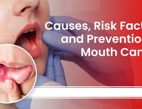 Causes, Risk Factors, and Prevention of Mouth Cancer