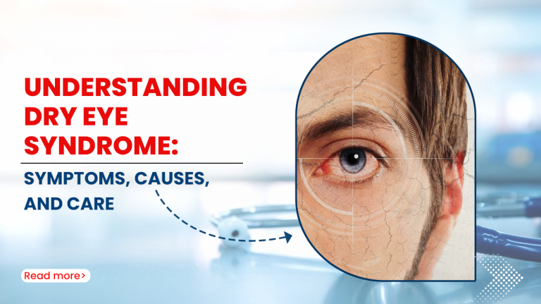 Understanding Dry Eye Syndrome: Symptoms, Causes, and Care